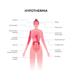 Frostbite and hypothermia health care infographic collection. Vector flat design healthcare illustration. Woman body anatomy slice scheme with inner organ with hypothermia warning sign with text