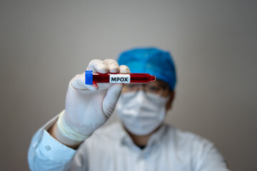 Monkeypox(MPOX) PCR test tube in doctors hand