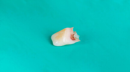 Obraz na płótnie Canvas Children's milk tooth on a green background, macro. Pediatric dentistry, extraction of milk teeth in children. Dental surgery