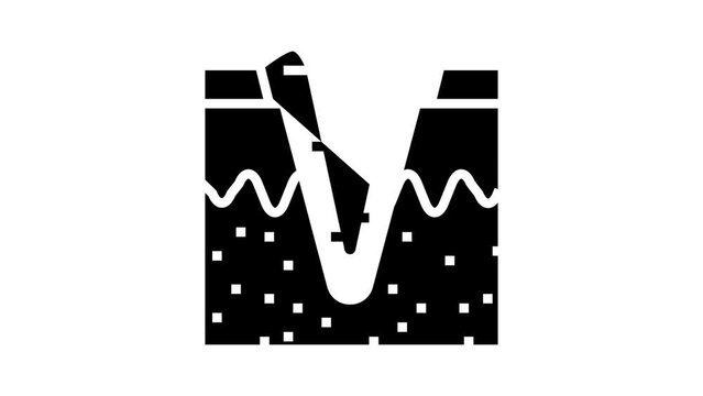ice pick acne scar glyph icon animation