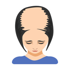 Severe baldness, alopecia in women vector illustration. Top of female head with bald spot on scalp isolated on white background. Health, hair loss or treatment concept