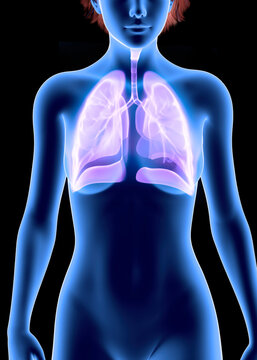 Human anatomy, problems with the respiratory system, severely damaged lungs. Bilateral pneumonia. Effects of smoking on the lungs