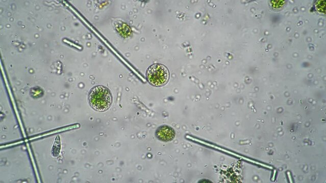 Close-up the smooth movement of camera for panning various bacteria in laboratory under microscope. Microbes move quickly with tendrils in special liquid. Research scientists a unicellular organisms.