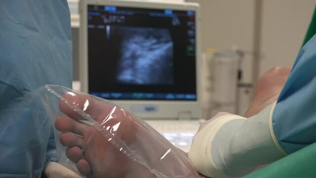 Varicose veins are veins that have become enlarged and twisted.The term commonly refers to the veins on the leg, although varicose veins can occur elsewhere.