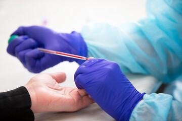 Taking blood for a general analysis, a clinical blood test. Collection of blood.