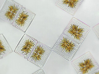 Striatella unipunctata algae under microscopic view, phytoplankton, fossils, silica, golden yellow...