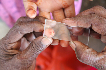 Blood Sample taking on the glass slide.