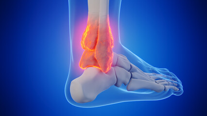 3d rendered medical illustration of a man's ankle - obrazy, fototapety, plakaty