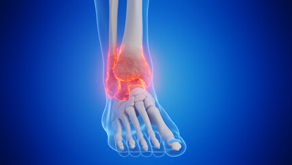 3d rendered medical illustration of a man's ankle
