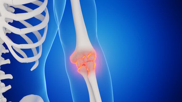 3d rendered medical illustration of a man's elbow joint