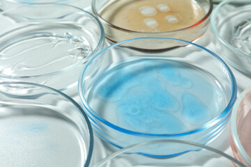 Petri dishes with liquids on white table, closeup