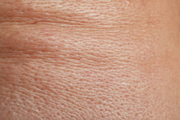 Closeup view of human skin as background