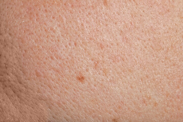 Fototapeta premium Closeup view of human skin as background