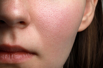 Closeup view of woman with normal skin