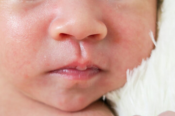 新生児の赤ちゃんの口と鼻のアップ - obrazy, fototapety, plakaty