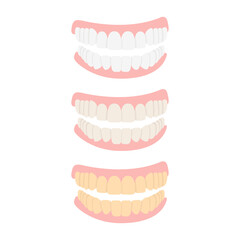 Tooth dental plaque stages icon set. Teeth in different stages of color change development. Flat cartoon vector illustration isolated on background. Dental hygiene, whitening, and treatment concept.