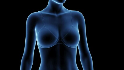 3d rendered medical animation of a woman after breast enhancement