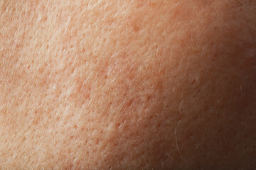 Fototapeta premium Closeup view of human skin as background