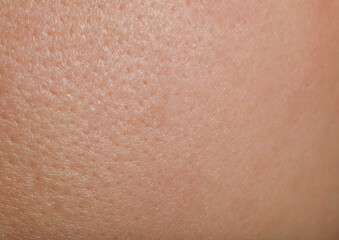 Closeup view of human skin as background