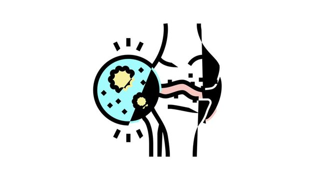 infectious arthritis color icon animation