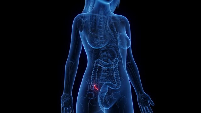 3d rendered medical animation of the appendix of a woman