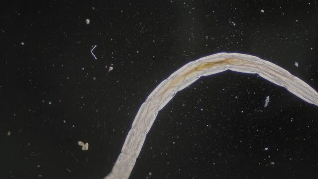 Fast moving nematode trematode worm under microscope dark field view