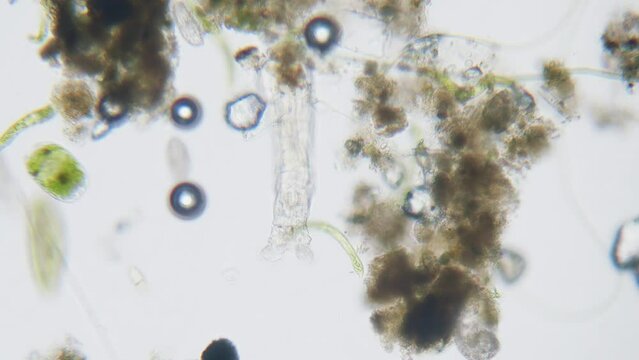 Different freshwater  species of protozoa single cell organisms as stentors, ciliates and algae movement under microscope bright filed view