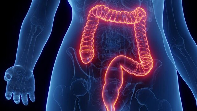 3d rendered medical animation of a woman's colon and rectum