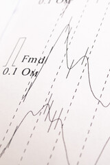 Research schedule Rheoencephalography on a white paper