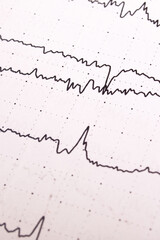 Electroencephalogram graph on white paper close up