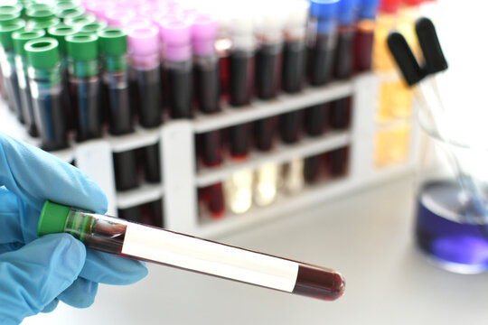 Medical worker lab technician holding vial of blood for testing, blank label mock up text overlay - Powered by Adobe