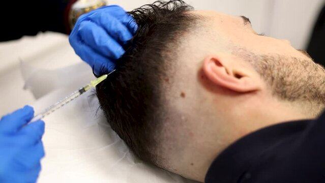 Close-up.Young man receiving hair treatment in a beauty salon. Man having mesotherapy session in aesthetic clinic, therapist hands in gloves making scalp injection