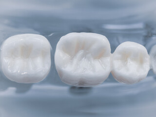 Close up of dentistry practise teeth
