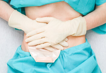 A patient in pajamas with an open abdomen presses the colostomy bag with hands in sterile gloves.