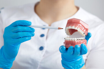 Orthodontist showing model of human jaw with wire braces and aligners explaining the difference