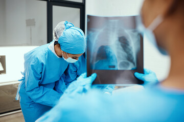 Xray, body and surgery team in hospital, consulting for cancer tumor healthcare wellness or...