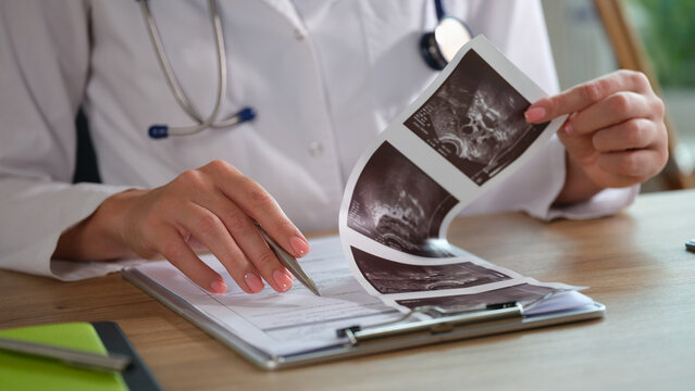 Female doctor analyzes ultrasound results for patient diagnosis.