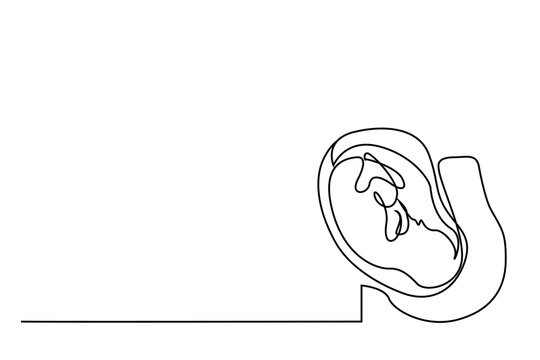 recommend clip art: unborn baby fetus object health in the womb