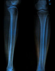 x ray of knee