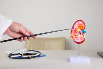 doctor nephrologist pointing at pyelonephritis showing pus,infection,scarring and atrophy on a kidney mockup on his desktop