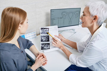 Gynecologist showing woman ultrasound of her ovaries during female patient visit to gynecology....
