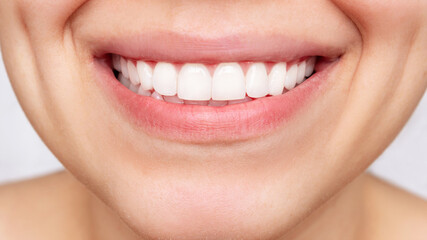 Result of veneers installation. Cropped shot of young caucasian smiling woman demonstrating perfect...