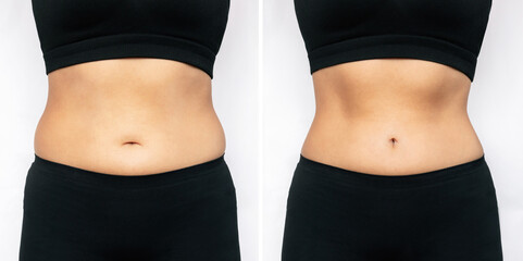 Cropped shot of a woman with excess fat and toned slim stomach before and after losing weight...