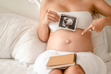 Close up Pregnant woman holding ultrasound scan photo on her belly. Mother with sonogram of her...