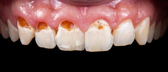 dental photography picture of dental treatment case