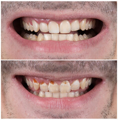 dental photography picture of dental treatment case