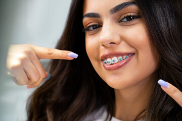 Cute young woman with dental braces smiling and pointing to them