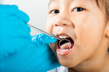 Dental kid health examination. Doctor examines oral cavity of little child uses mouth mirror to checking teeth cavity, Asian dentist making examination procedure for smiling cute little girl