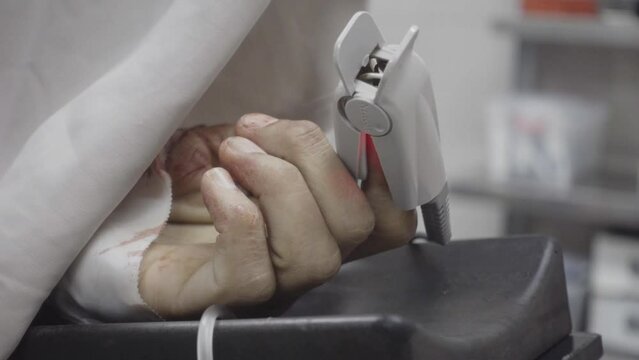Measuring device on bloody patient finger in Kabul hospital