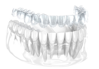 Invisalign braces or invisible retainer make bite correction. 3D illustration